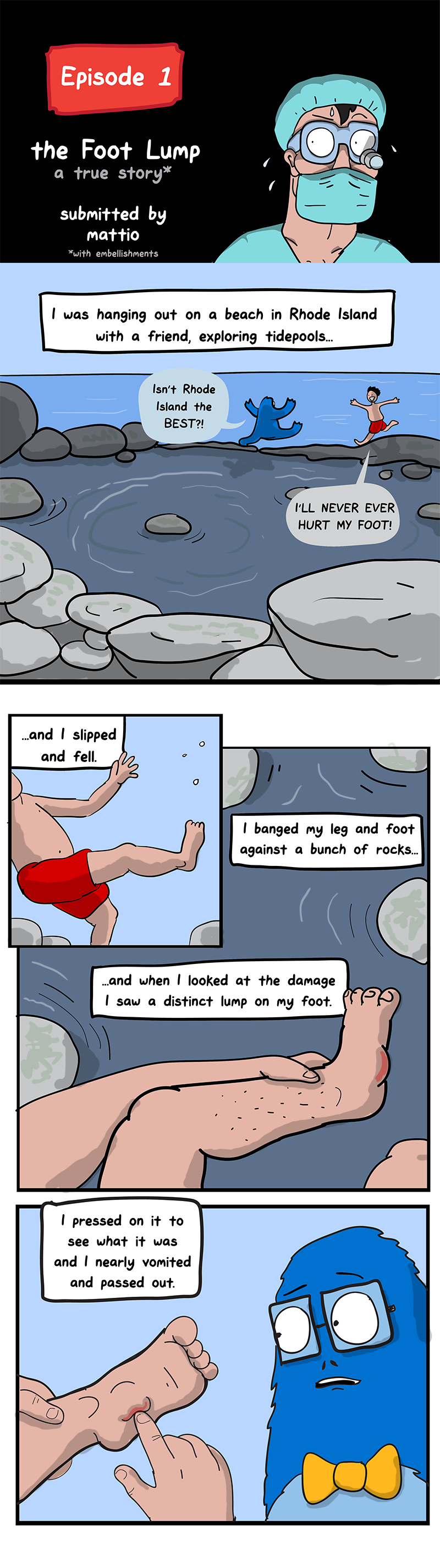 01_The-Foot-Lump-01